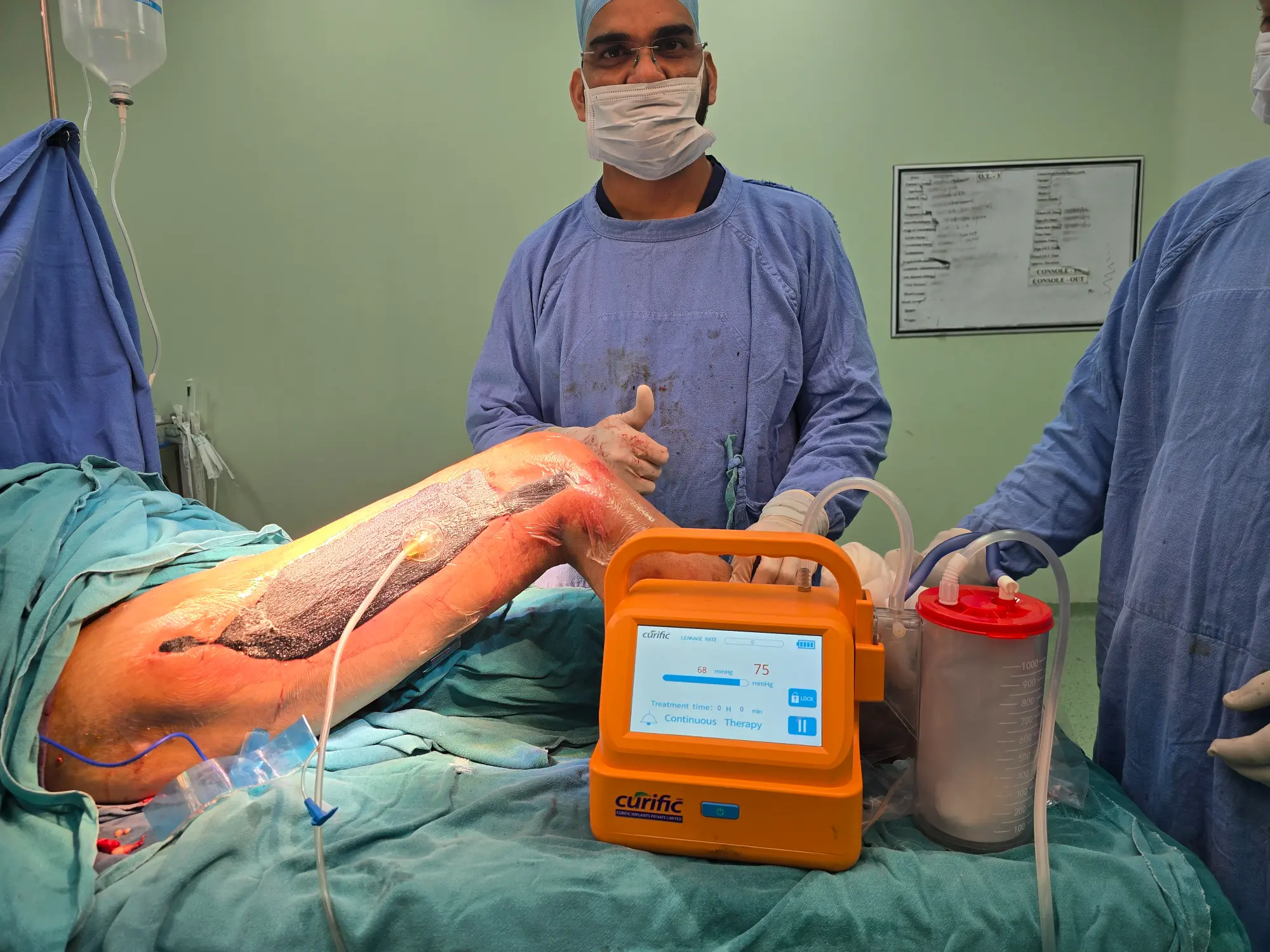 Curific NPWT Kit in action by Dr Rukhsar Ahmed in Delhi