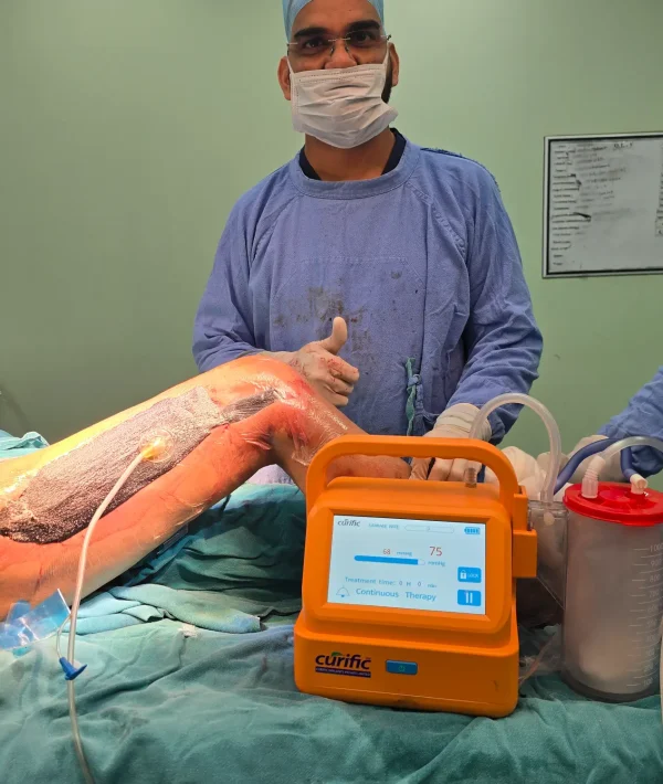 Curific NPWT Kit in action by Dr Rukhsar Ahmed in Delhi